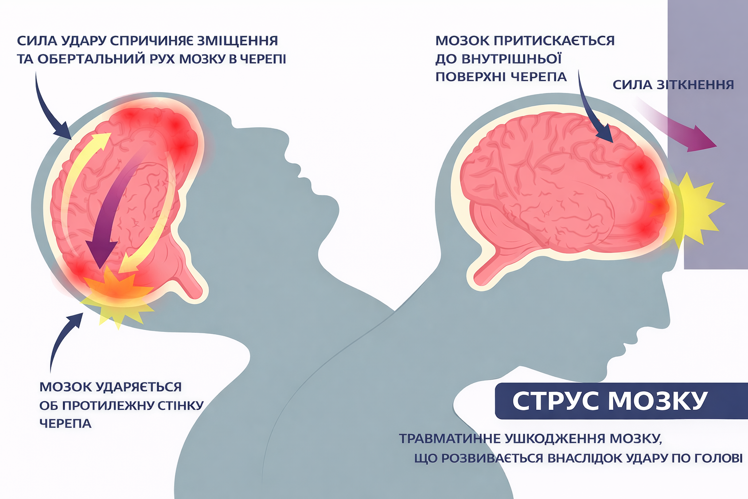 Черепно-мозкова травма