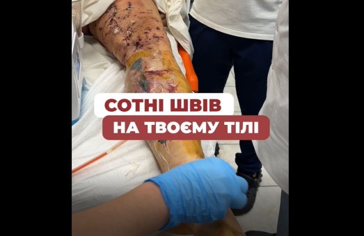 Їх збирають буквально по шматочках… Але вони усміхаються ❤️‍🩹