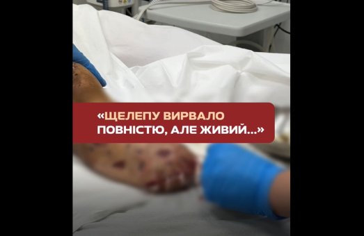 «Головне — живий, решту вилікуємо…» ❤️