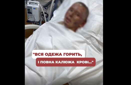 Після 6 діб коми Максим відкрив очі… Йому лише 15 ❤️‍🩹