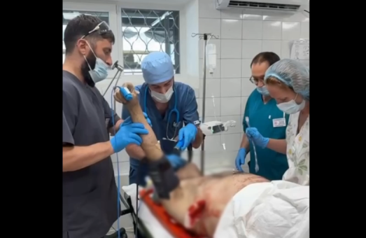 Один за одним: важкі дні в реанімації Лікарні Мечникова